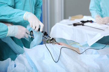 Abdominal surgery. Surgical intervention through small holes. Team of surgeons. Laparoscopic...