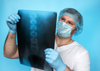 The doctor surgeon analyzes the injury of the human spine X-ray of the spine in the doctor's hands. Vertebrologist in the office. Doctor orthopedist-traumatologist Diagnosis of treatment
