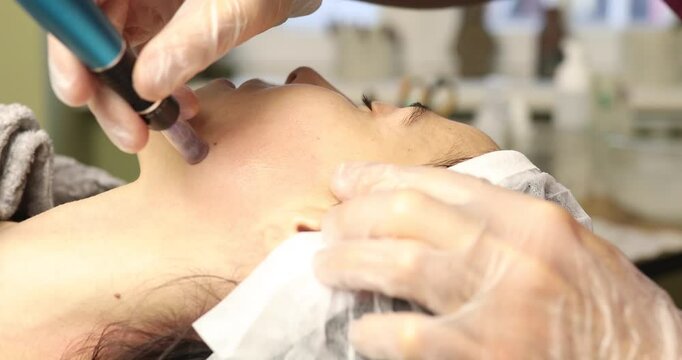 beautiful young woman on a facial dermapen micro-needling treatment at the beauty salon. Woman is getting a facial treatment with a device.