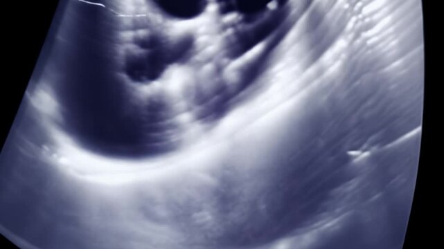 Ultrasound imagery reveals internal organs