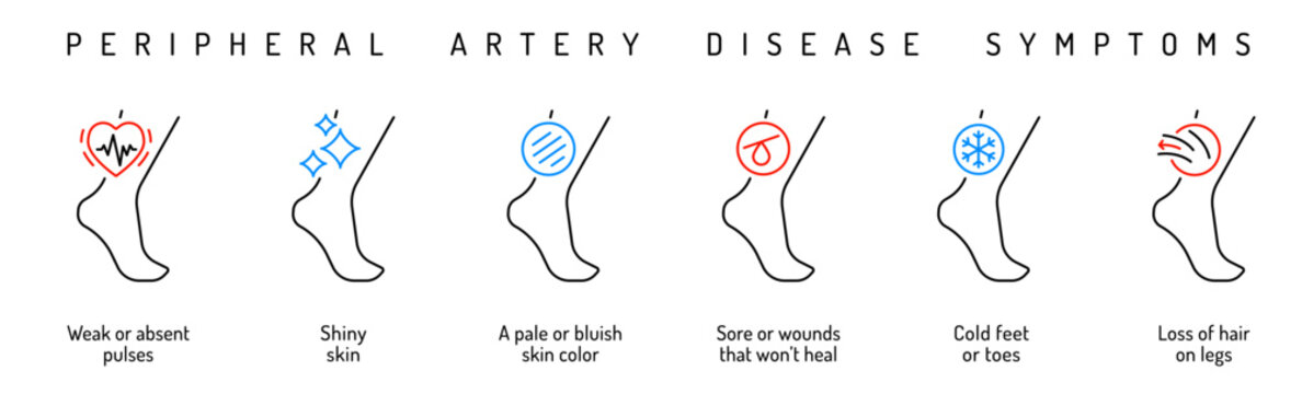 Vascular health. PAD early detection. Blood vessels disease.