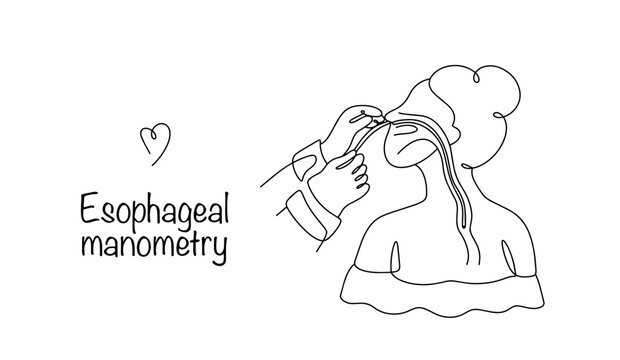 Esophageal manometry