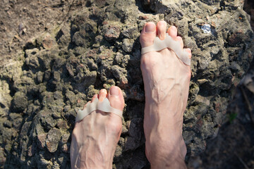 Feet with silicone toe separators rest on a rocky surface, showcasing an innovative way to improve toe alignment while engaging in outdoor activities