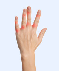 Obraz premium Woman with joint inflammation on white background, closeup. Red areas on fingers