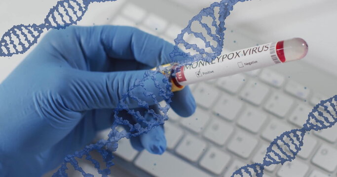 Image of blue dna strands over gloved hand holding monkey pox blood sample test tube