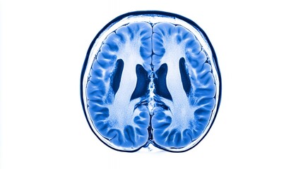 MRI scan of human brain revealing internal structures and vital cerebral features in blue tones