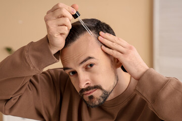 Handsome man applying serum for hair growth in bathroom, closeup