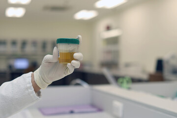 A laboratory technician holding a urine sample in a medical lab. The sample is contained in a...