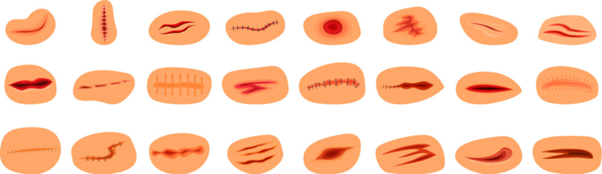 Bloody wounds icons set. Set of various wounds, illustrating different levels of skin damage, including cuts, scratches, and stitched areas