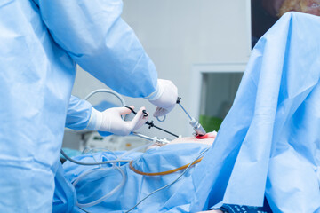 abdominal surgery, laparoscopy, cholecystectomy, removal of the gallbladder using an endoscope and...