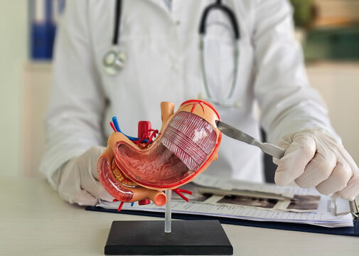 Surgeon held scalpel over an anatomical model of human stomach. Photosurgical treatment of stomach diseases and procedures
