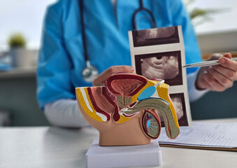 Model of male reproductive system anatomy in a doctor office concept