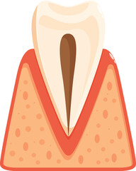 Dental cross section showing receding gums, periodontitis, and tooth decay affecting dentin and pulp