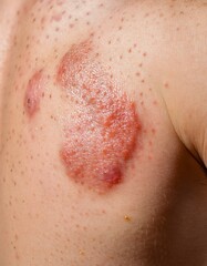 Fototapeta premium Close-Up Study of Skin Allergy and Dermatitis Patterns