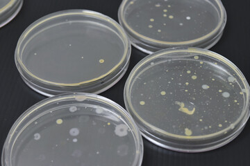 Colonies of bacteria growth on agar plate medium in laboratory.	
