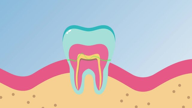 Toothache Icon, and Tooth Extraction or tooth removal, The process of cleaning teeth with laser technology, in the form of 4K format vector animation.
