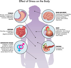 Medical illustration of effect of stress on the body, with annotations.