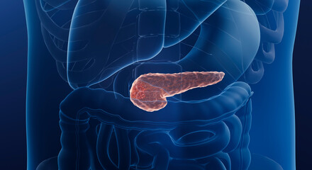 3d illustration of pancreas cancer