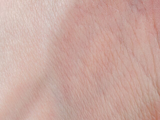 A photograph of human skin showing texture, shades and nature, highlighting uniqueness and elasticity.