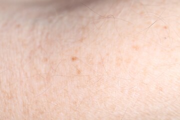 Texture of healthy skin as background, closeup
