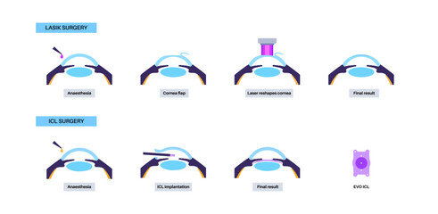 LASIK and ICL EVO © pikovit