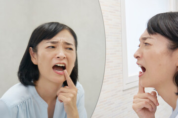 歯の悩み　50代の女性