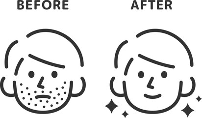 髭脱毛の、ビフォーアフターのアイコン（線画）のイラスト