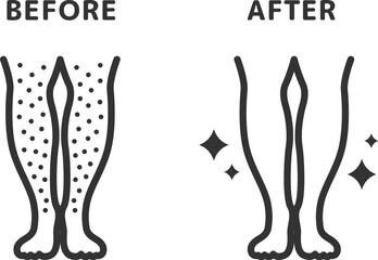 足脱毛の、ビフォーアフターのアイコン（線画）のイラスト