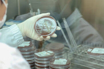Scientist examining a petri dish with bacterial cultures in a laboratory environment. Gonorrhea...