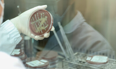 Laboratory technician analyzes culture in petri dish, To diagnose gonorrhea accurately, laboratory...
