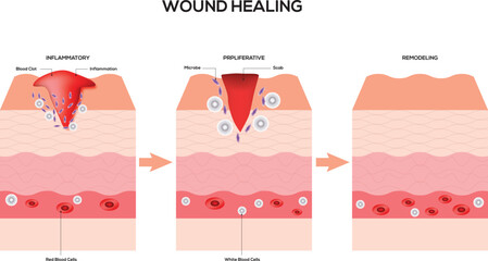 Wound Healing Science Design Vector Illustration Diagram