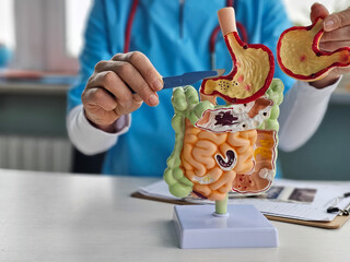 Surgeon held scalpel over an anatomical model of human stomach