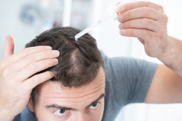 Man using hair loss treatment on his scalp