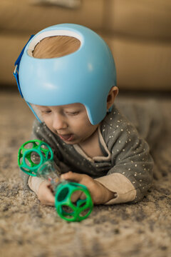 a baby boy wearing a blue Helmet for molding therapy, for cranial orthosis for plagiocephaly while playing with a toy on the carpet
