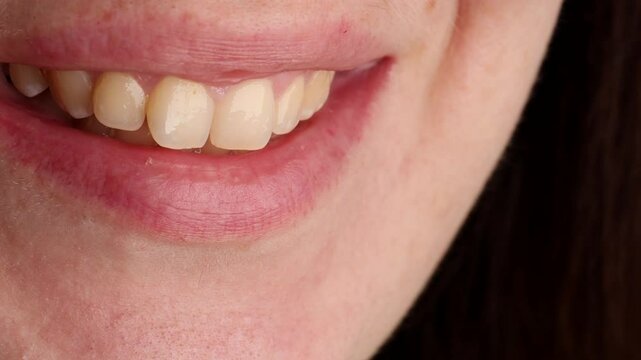Woman smiles close-up, black hair on upper lip. Smile highlights plaque on teeth and hormonal imbalance. Scene emphasizes health, hygiene, and self-care concerns.