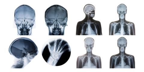 Various X-Ray Images of Human Anatomy, PNG collection, set bundle, isolate on transparent or white background