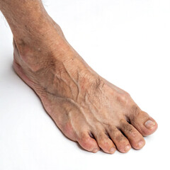 Close Up Of An Old Man's Foot With Veins Isolated On White Background