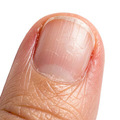 Closeup Of Clean Fingernails Without Nail Polish Isolated On White Background