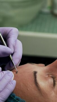 Female client is in the beauty salon. Cosmetician uses instrument for blackhead removal. Side view close up. Vertical video