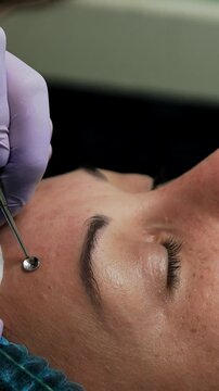 Careful cosmetologist uses the tool to remove blackheads from the female client's skin. Face care and beauty concept. Close up. Vertical video