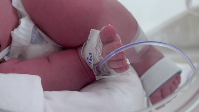 Close up of an infant in critical care unit's incubator