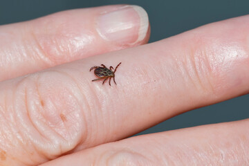 Wiesenzecke (Dermacentor reticulatus) (Männchen)	