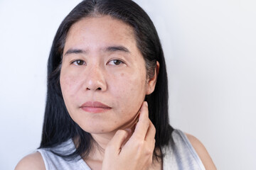 Female face with wrinkled skin problems Blemishes and dark spots Blackheads on the tip of the nose Lack of moisture, lack of nourishment Pores in oily skin uneven skin tone Skin care concepts.