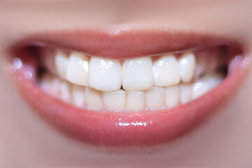 Close up of a female smiling white teeth for dentist or dental background