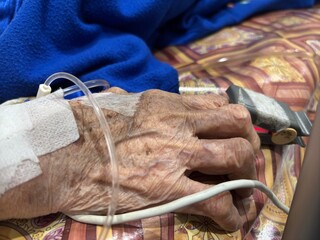 A close-up shot of an elderly person's hand with visible wrinkles and age spots. The hand is secured with medical tape for an intravenous (IV) line, connected to a clear tube, and a pulse oximeter