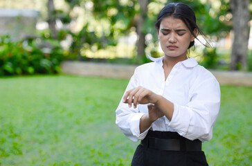Itching and allergic Asian woman scratching her hand skin, concept of dry skin, allergic skin inflammation, body care, fungus inflammation, dermatology disease, eczema, rash, skin care