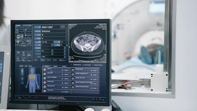 Doctor supervises the imaging analysis of the sick persons body. Doctor observing lungs analysis done by the medical imaging equipment. MRI, CT scanner diagnosis on computer, PC. Computed tomography