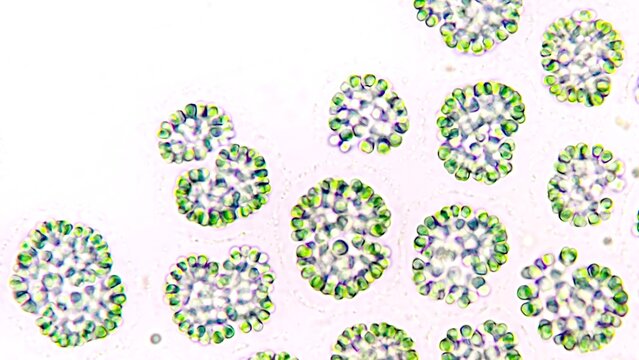 Freshwater cyanobacteria blooming under microscope. The species is probably Gomphosphaeria sp. Selective focus image