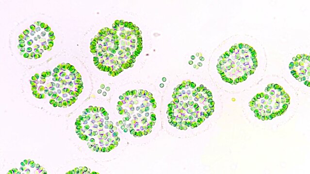 Freshwater cyanobacteria blooming under microscope. The species is probably Gomphosphaeria sp. Selective focus image