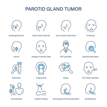 Parotid Gland Tumor symptoms, diagnostic and treatment vector icon set. Medical icons.